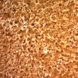 Arginase 1 (Hepatocellular Carcinoma Marker); Clone ARG1/1126 (Concentrate)